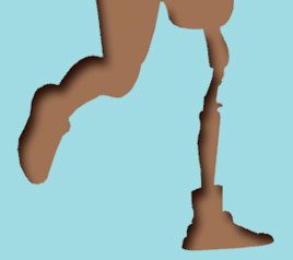 ④ “의족은 신체의 일부인가?”<br>20년간 인권위만이 적극적으로 답해야 했던 물음과 앞으로의 물음[1]